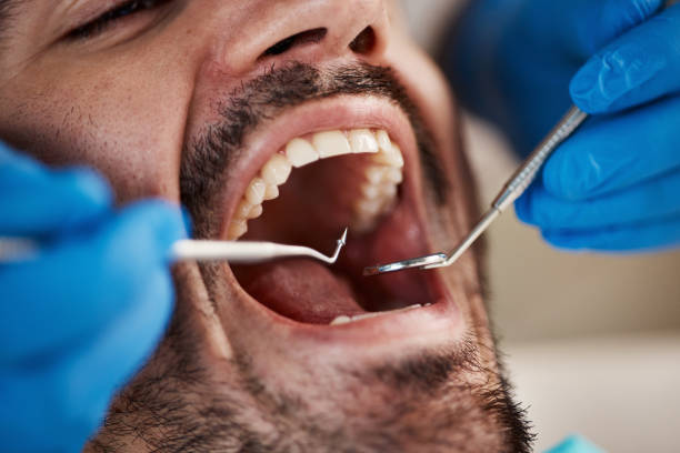 Best Full Mouth Reconstruction  in Wellston, MO